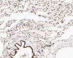 NuMA Antibody in Immunohistochemistry (Paraffin) (IHC (P))