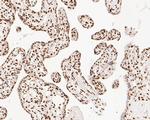 NuMA Antibody in Immunohistochemistry (Paraffin) (IHC (P))