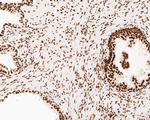 NuMA Antibody in Immunohistochemistry (Paraffin) (IHC (P))