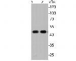 SARS-CoV-2 Nucleocapsid Antibody in Western Blot (WB)