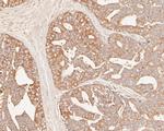 GADD34 Antibody in Immunohistochemistry (Paraffin) (IHC (P))