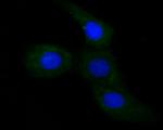 ApoER2 Antibody in Immunocytochemistry (ICC/IF)