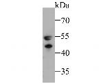 WARS Antibody in Western Blot (WB)