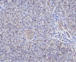 PSMD14 Antibody in Immunohistochemistry (Paraffin) (IHC (P))