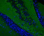 Synapsin II Antibody in Immunohistochemistry (Paraffin) (IHC (P))