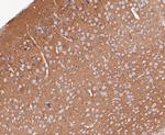 Synapsin II Antibody in Immunohistochemistry (Paraffin) (IHC (P))