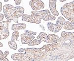 PRKAR2A Antibody in Immunohistochemistry (Paraffin) (IHC (P))