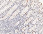 SENP2 Antibody in Immunohistochemistry (Paraffin) (IHC (P))