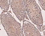 eIF3b Antibody in Immunohistochemistry (Paraffin) (IHC (P))