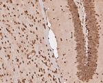 eIF3e Antibody in Immunohistochemistry (Paraffin) (IHC (P))