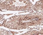 ABI2 Antibody in Immunohistochemistry (Paraffin) (IHC (P))