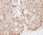 DP1 Antibody in Immunohistochemistry (Paraffin) (IHC (P))