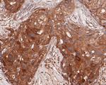 ARF5 Antibody in Immunohistochemistry (Paraffin) (IHC (P))