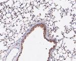 ARF5 Antibody in Immunohistochemistry (Paraffin) (IHC (P))