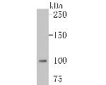 MSH2 Antibody in Western Blot (WB)