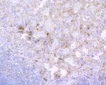 CD38 Antibody in Immunohistochemistry (Paraffin) (IHC (P))