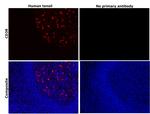 CD38 Antibody in Immunohistochemistry (Paraffin) (IHC (P))