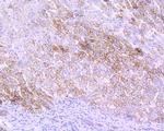 Villin Antibody in Immunohistochemistry (Paraffin) (IHC (P))