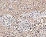 PAX2 Antibody in Immunohistochemistry (Paraffin) (IHC (P))