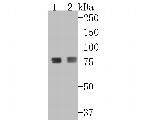 beta glucuronidase Antibody in Western Blot (WB)