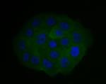 CHMP2B Antibody in Immunocytochemistry (ICC/IF)