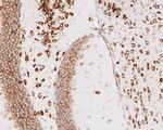 RPL7A Antibody in Immunohistochemistry (Paraffin) (IHC (P))