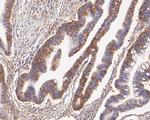 GOT2 Antibody in Immunohistochemistry (Paraffin) (IHC (P))