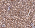 GOT2 Antibody in Immunohistochemistry (Paraffin) (IHC (P))