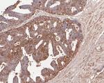 TNFRSF19 Antibody in Immunohistochemistry (Paraffin) (IHC (P))