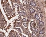 TNFRSF19 Antibody in Immunohistochemistry (Paraffin) (IHC (P))