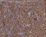 GAA Antibody in Immunohistochemistry (Paraffin) (IHC (P))