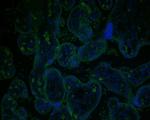 GAA Antibody in Immunohistochemistry (Paraffin) (IHC (P))