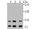 GAA Antibody in Western Blot (WB)