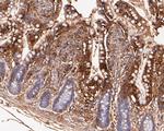 VEGFD Antibody in Immunohistochemistry (Paraffin) (IHC (P))