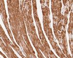 VEGFD Antibody in Immunohistochemistry (Paraffin) (IHC (P))