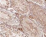 VEGFD Antibody in Immunohistochemistry (Paraffin) (IHC (P))