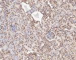 Tat-SF1 Antibody in Immunohistochemistry (Paraffin) (IHC (P))