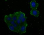 ARG2 Antibody in Immunocytochemistry (ICC/IF)