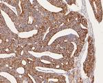 ARG2 Antibody in Immunohistochemistry (Paraffin) (IHC (P))