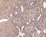 VPS28 Antibody in Immunohistochemistry (Paraffin) (IHC (P))