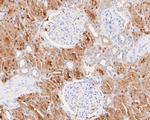 Glycerol kinase Antibody in Immunohistochemistry (Paraffin) (IHC (P))