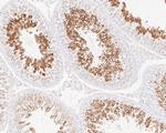 Glycerol kinase Antibody in Immunohistochemistry (Paraffin) (IHC (P))