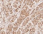 SUPT5H Antibody in Immunohistochemistry (Paraffin) (IHC (P))