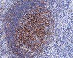 CD35 Antibody in Immunohistochemistry (Paraffin) (IHC (P))