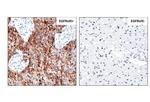 EGFRvIII Antibody in Immunohistochemistry (Paraffin) (IHC (P))