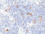 CD30 Antibody in Immunohistochemistry (Paraffin) (IHC (P))