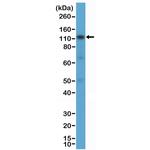 CD30 Antibody in Western Blot (WB)