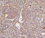 IRS1 Antibody in Immunohistochemistry (Paraffin) (IHC (P))