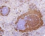 PAX5 Antibody in Immunohistochemistry (Paraffin) (IHC (P))