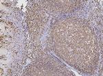 PAX5 Antibody in Immunohistochemistry (Paraffin) (IHC (P))